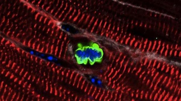 El trasplante de células procedentes de células madre adultas regenera el corazón en monos